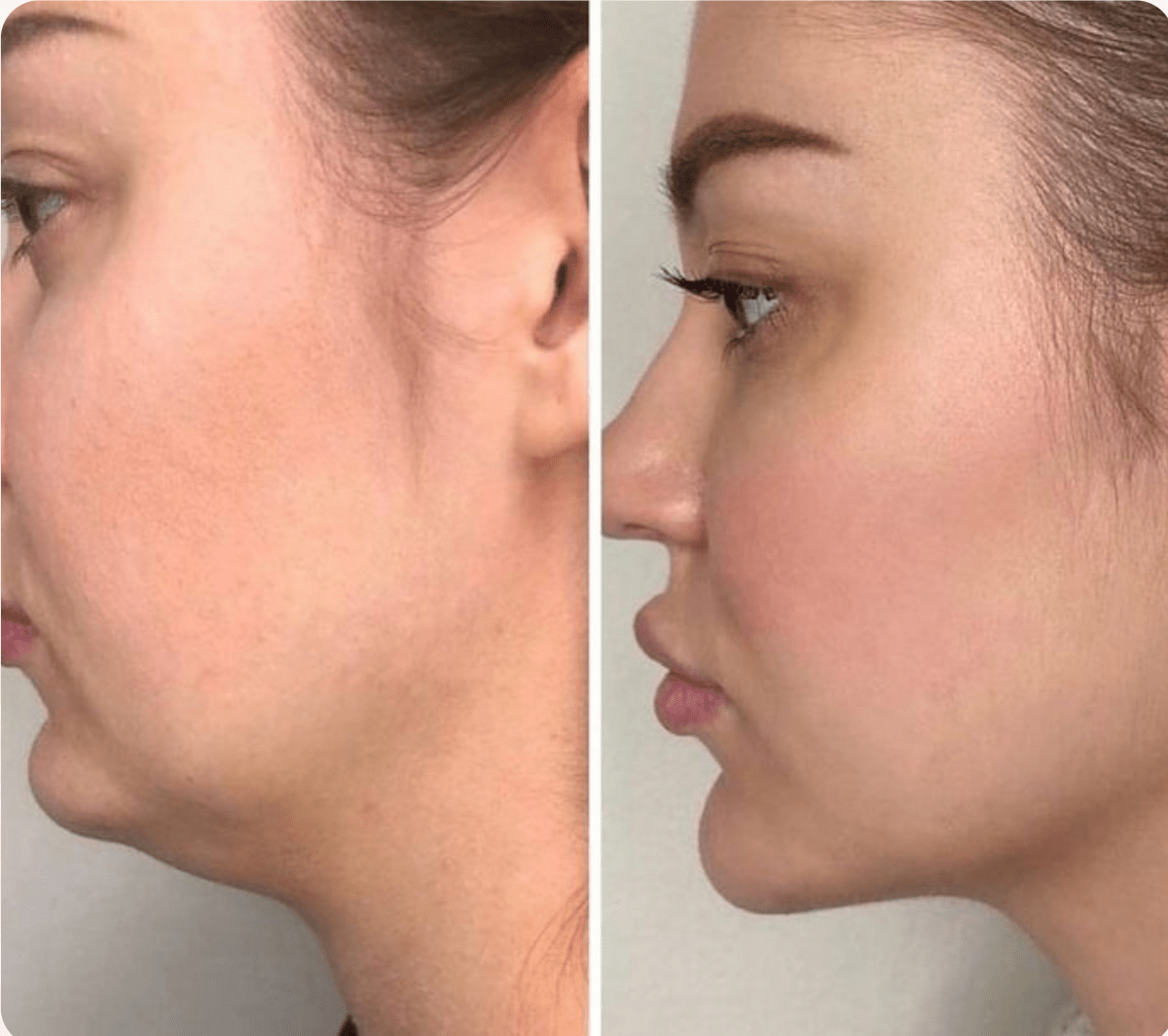 3 - in - 1 Face and Neck Massager - Dermovia™