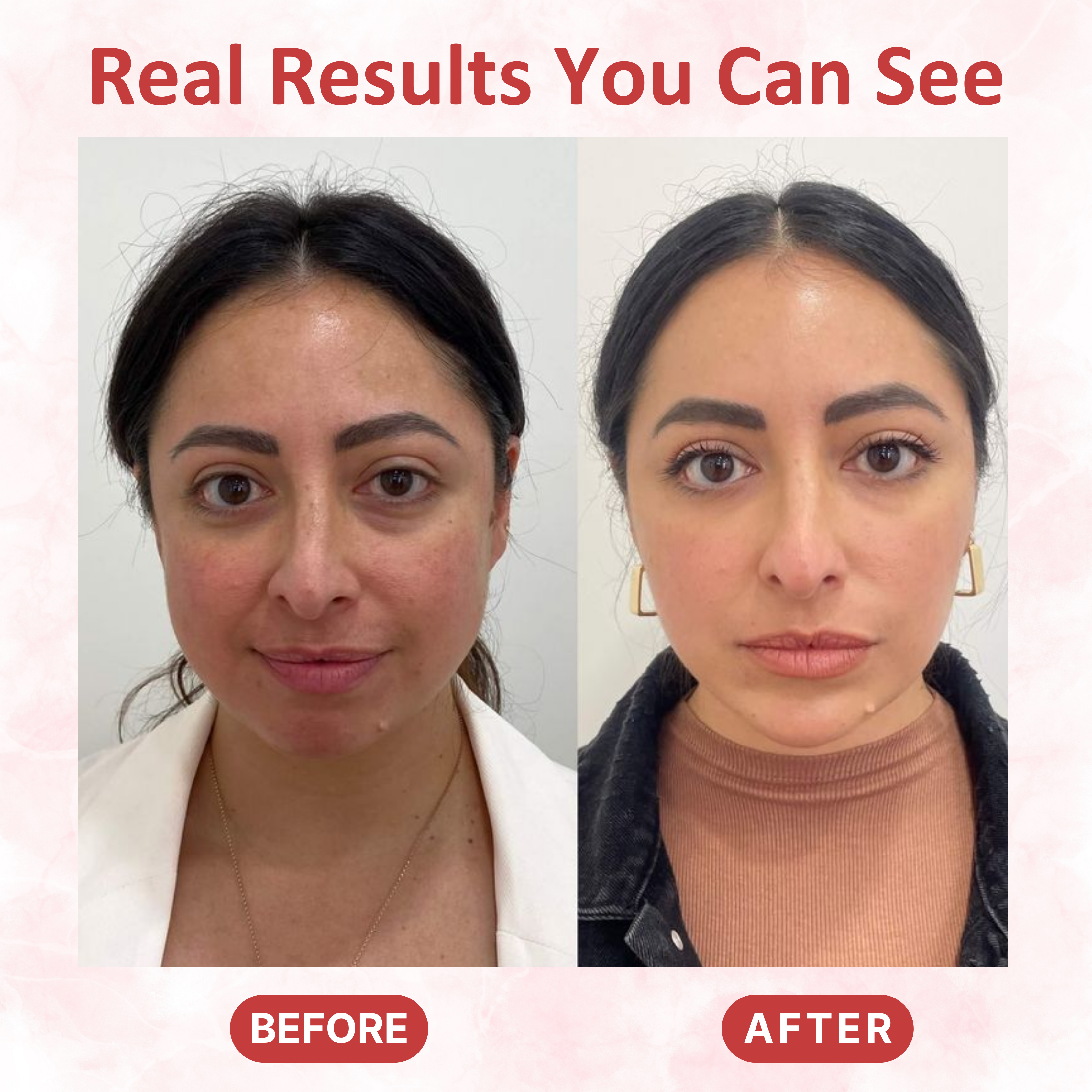 LED Face and Neck Mask