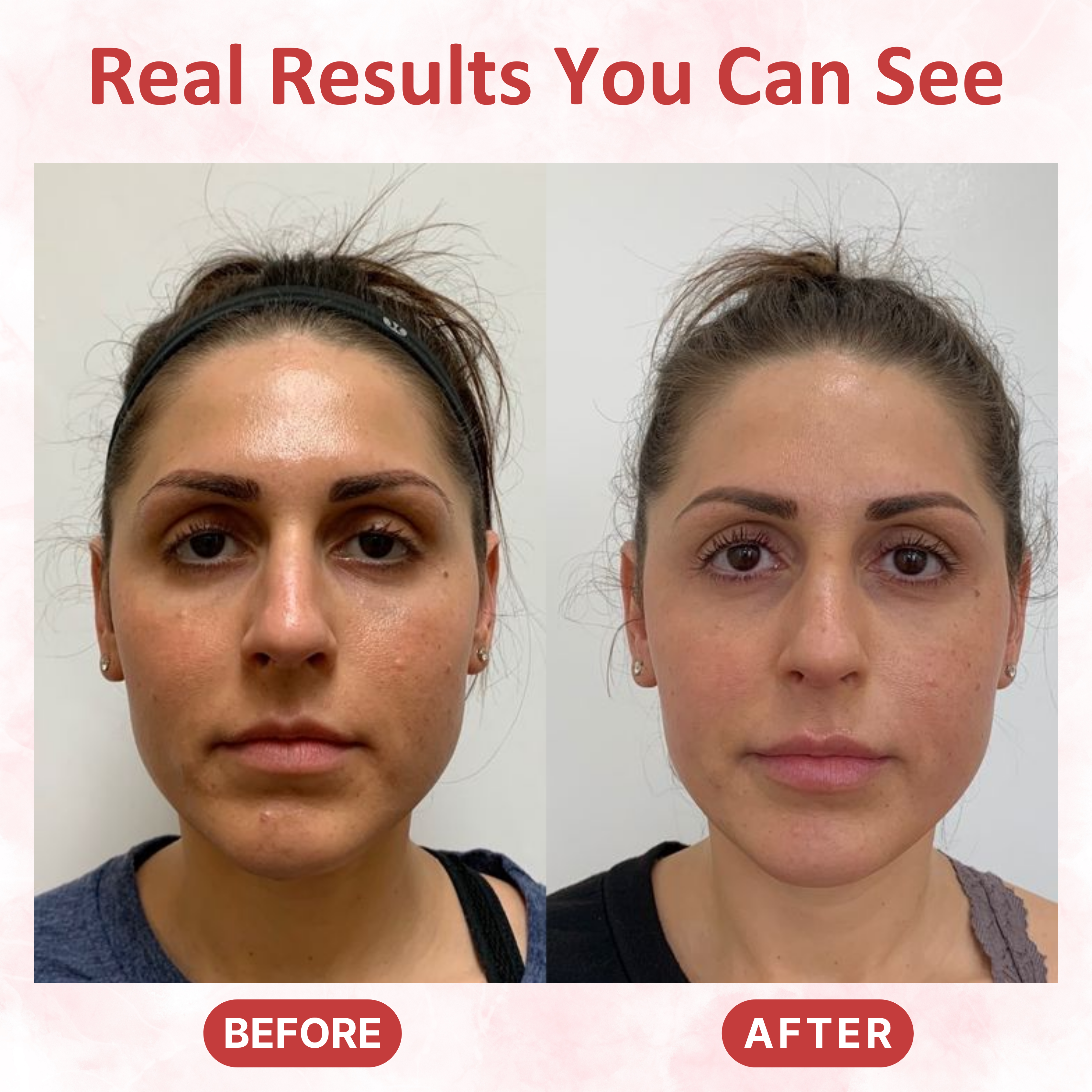 Activating Serum 70%