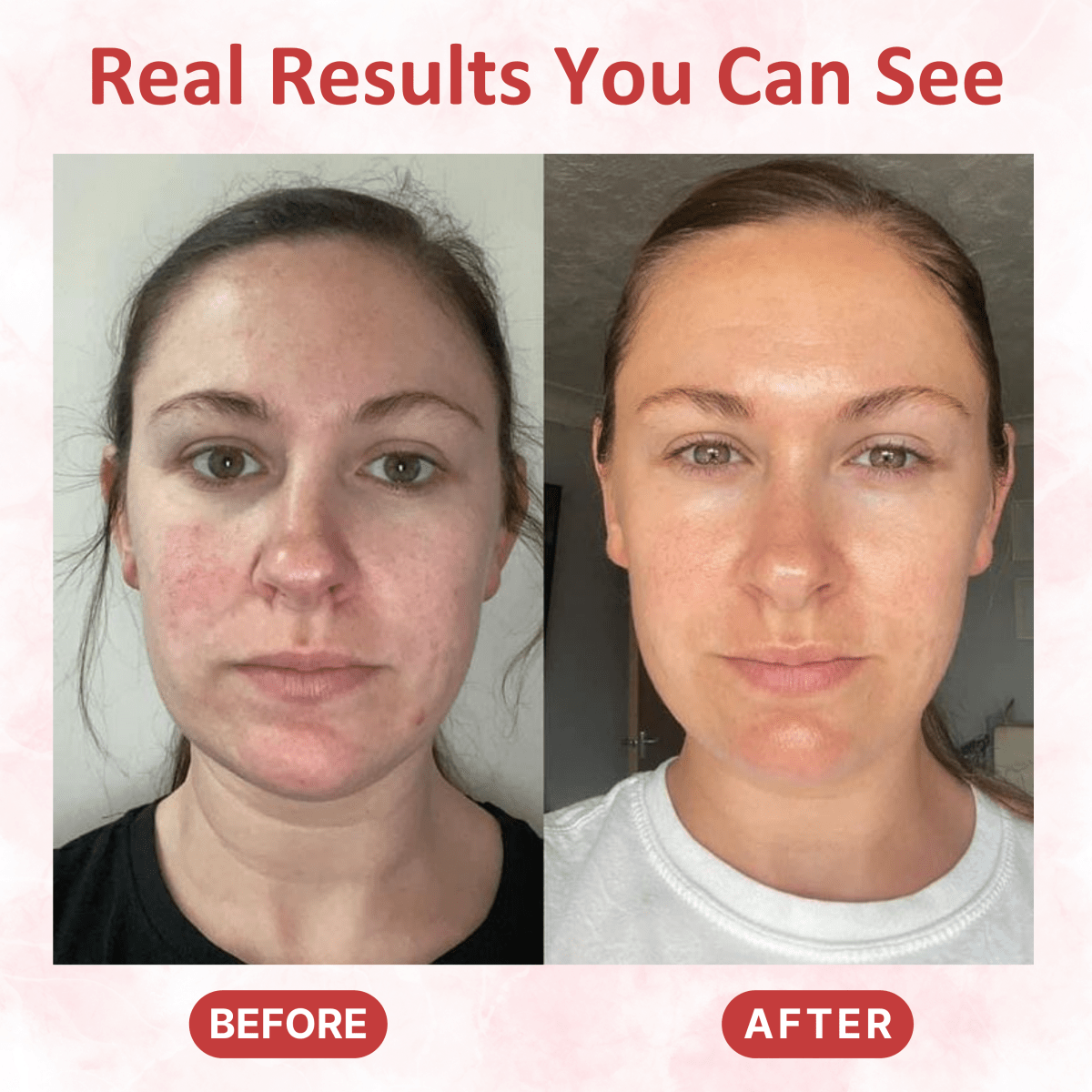 Activating Serum 70% - Dermovia™