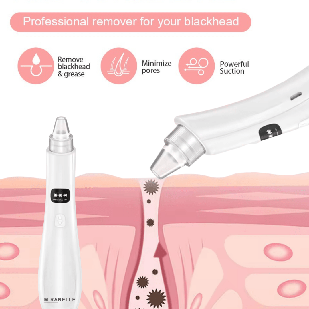 Blackhead Facial Remover - Dermovia™