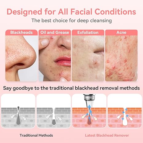 Blackhead Facial Remover - Dermovia™