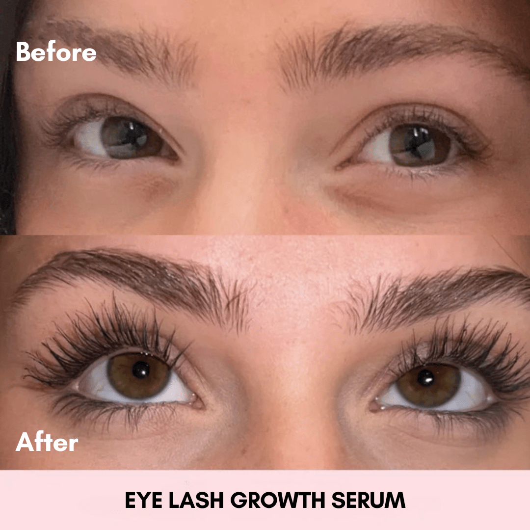 Eyelash Growth Serum - Miranelle™