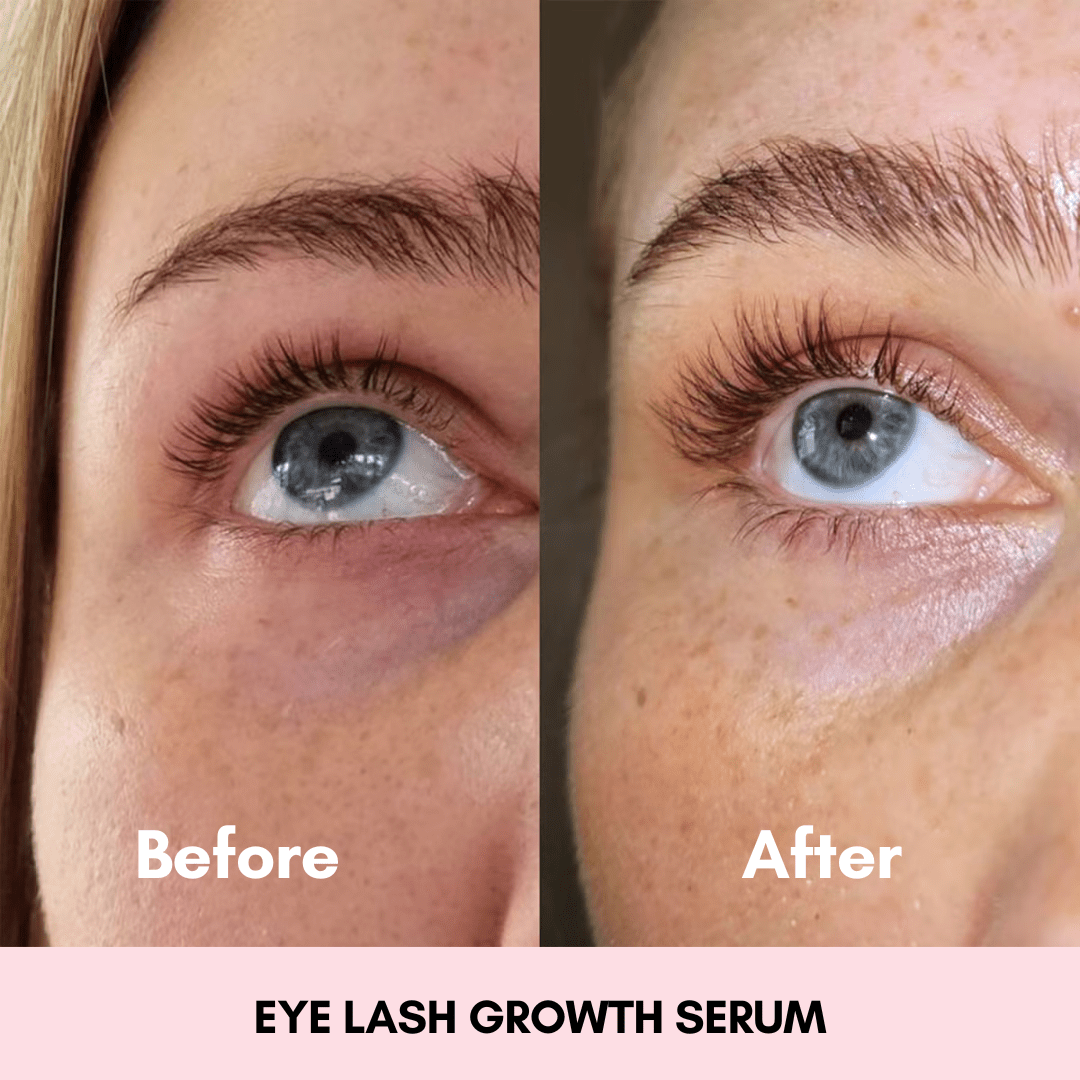 Eyelash Growth Serum - Miranelle™
