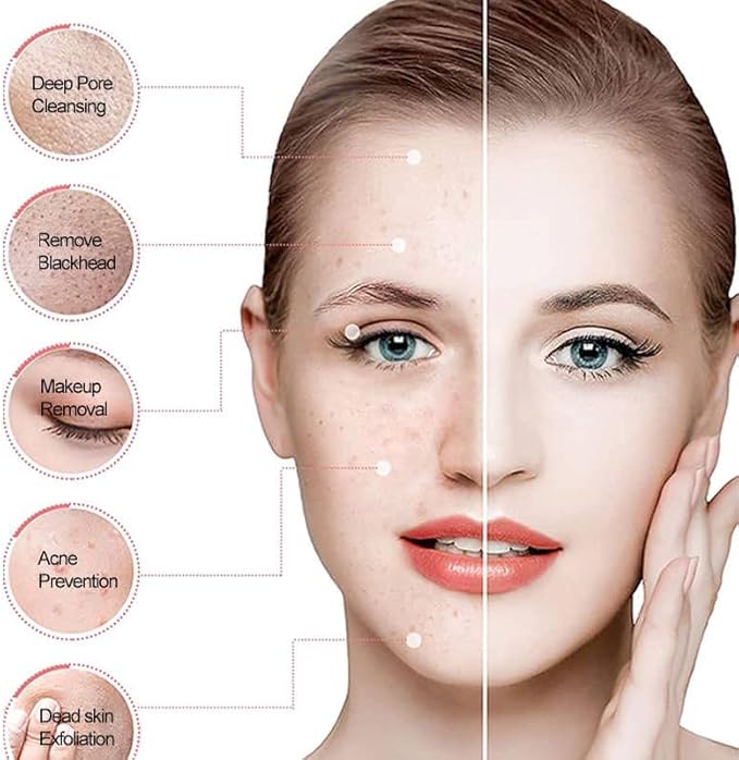 Facial Massager and Exfoliator - Dermovia™