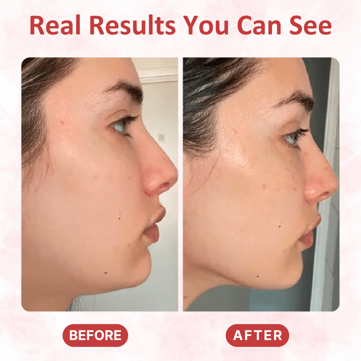 LED Gua Sha Massager - Dermovia™