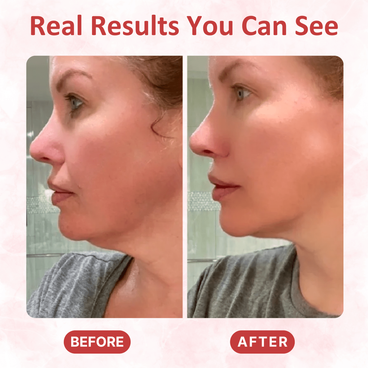 LED Gua Sha Massager - Dermovia™