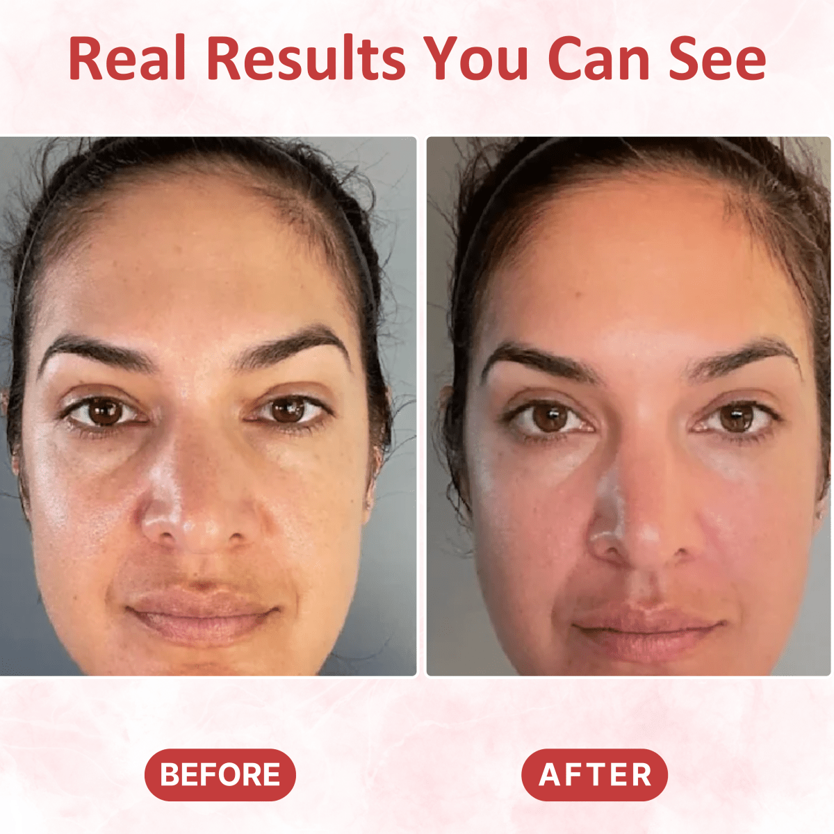 LED Gua Sha Massager - Dermovia™