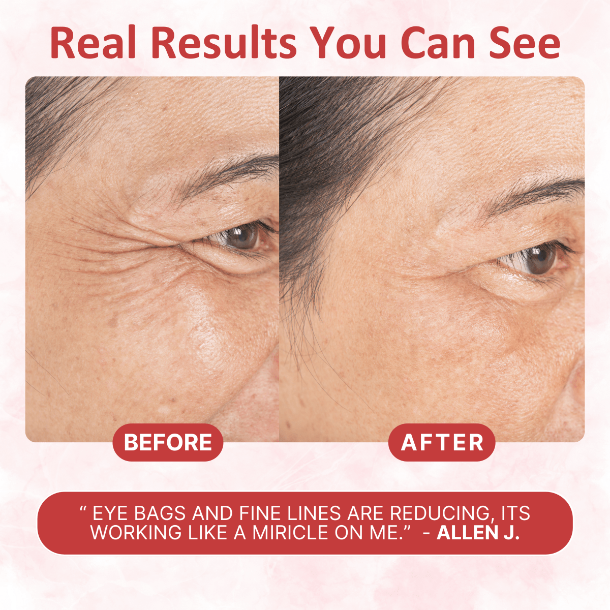Under Eye Collagen Patches - Dermovia™