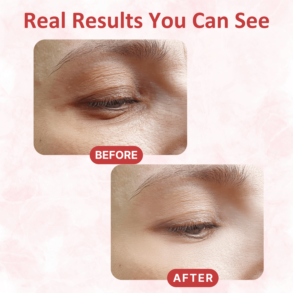 Under Eye Collagen Patches - Dermovia™
